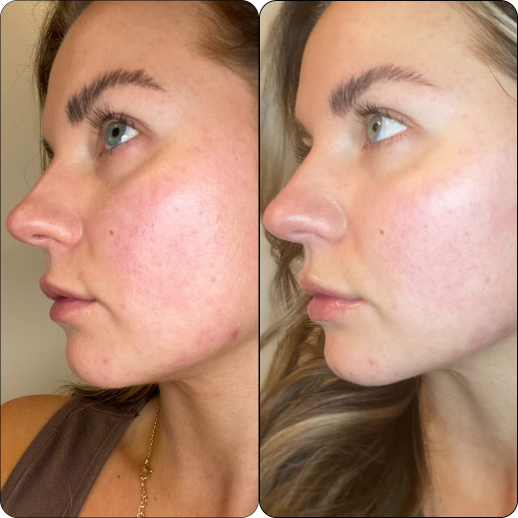 SimplyVital Collagen, Retinol & Hyaluronic Acid Cream